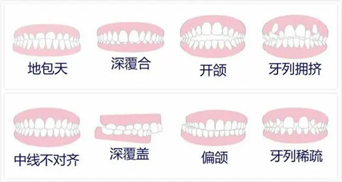 <a href='http://hk.szsbck.com' target='_blank'><u>深圳箍牙</u></a>