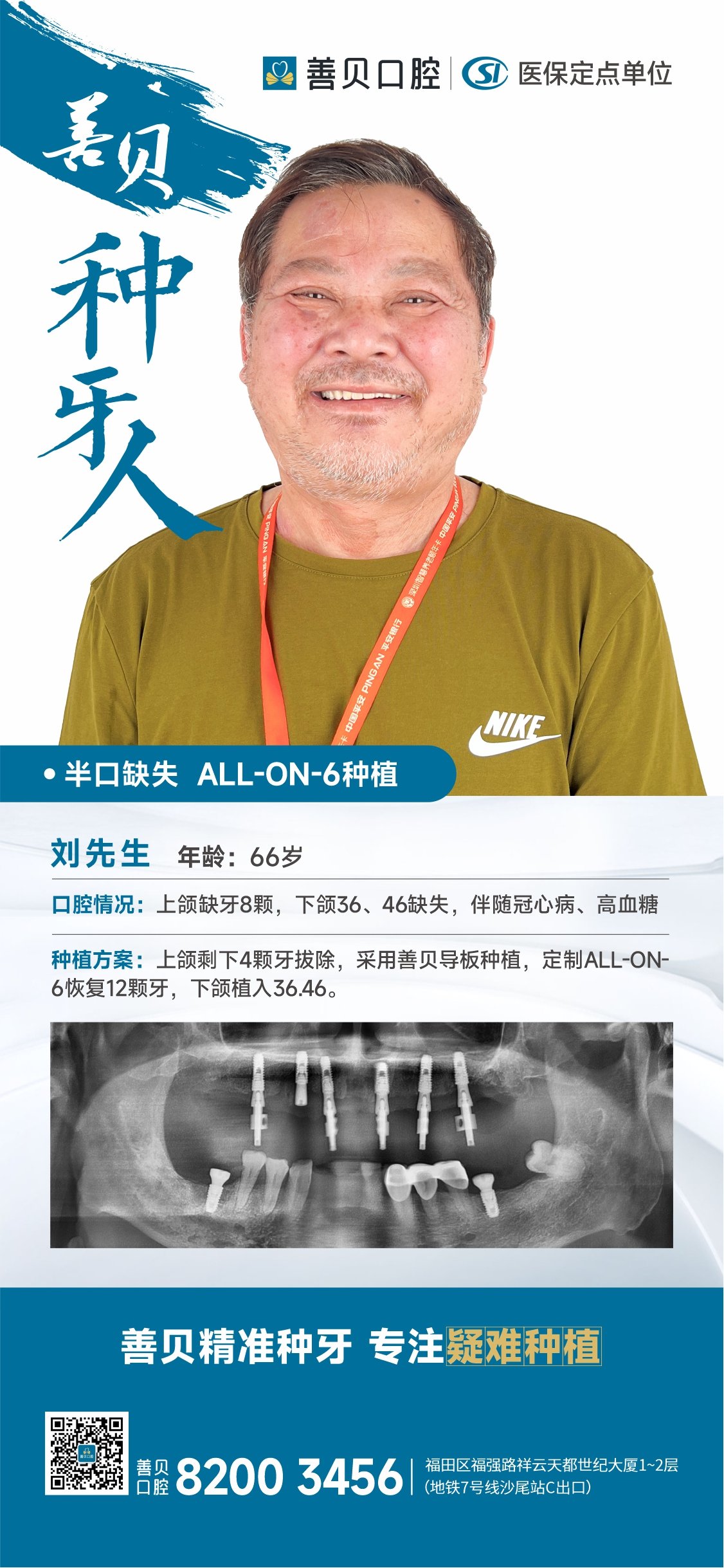 深圳牙科醫院,<a href='/' target='_blank'><u>深圳善貝口腔</u></a>,香港全口缺牙修复,<a href='/' target='_blank'><u>深圳善貝口腔</u></a><a href='/zhongzhiya/bankou/' target='_blank'><u>半口種植牙</u></a>修復病例